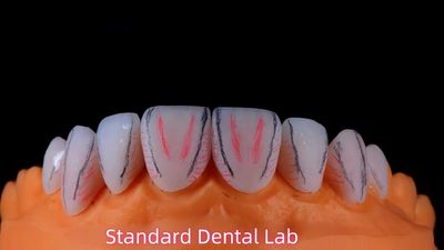 Standard Dental Lab Co., Limited productielijn van de fabrikant