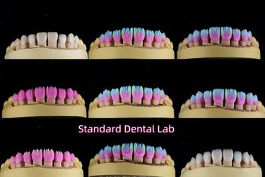 Standard Dental Lab Co., Limited productielijn van de fabrikant