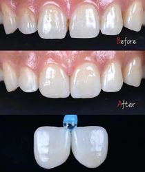 Standard Dental Lab Co., Limited productielijn van de fabrikant