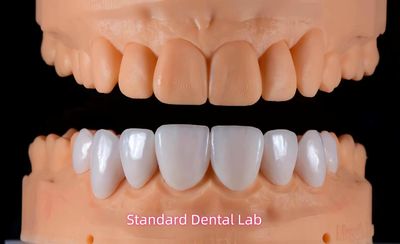 Standard Dental Lab Co., Limited productielijn van de fabrikant