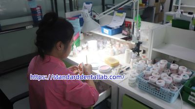 Standard Dental Lab Co., Limited productielijn van de fabrikant