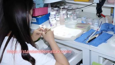 Standard Dental Lab Co., Limited productielijn van de fabrikant