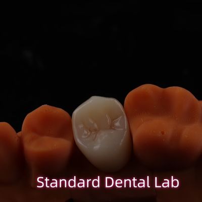 kopen Hoge esthetische BruxZir full contour Zirconia kronen PFZ brug online vervaardiging