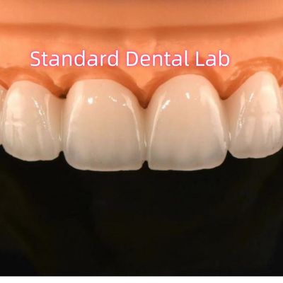 kopen Zirconia kronen brug tandheelkundig laboratorium met gelaagd porselein online vervaardiging