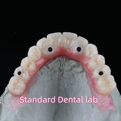 kopen Porselein Zirconia Tandheelkundige Implantatie Brug Professionele hoge esthetiek met roze kauwgom online vervaardiging
