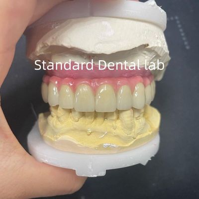 kopen Malo Bridge Hybrid Zirconia All On Four / Six Zirconia Implant Bridge Titanium Bar online vervaardiging