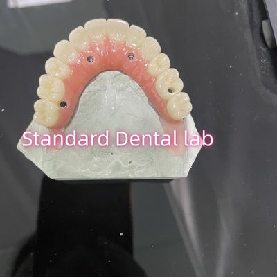 kopen All On Four Six Ivoclar Zirconia Implant Bridge Titanium Bar Met Roze Gum Porselein online vervaardiging