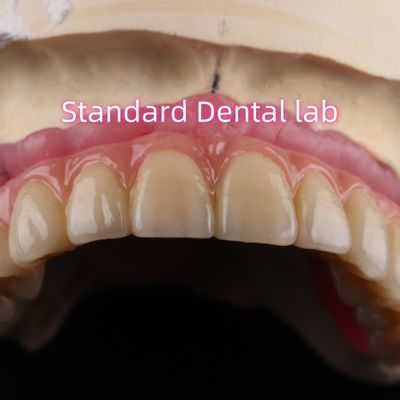 kopen Snel cement en tijdbesparende implantaten Tandheelkundige circonia kronen brug online vervaardiging
