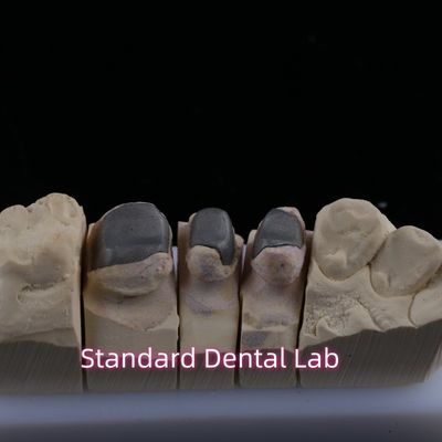 kopen Metalen gegoten post kern kroon Cocr Accurate Retentive Full Zirconia Bruxier online vervaardiging