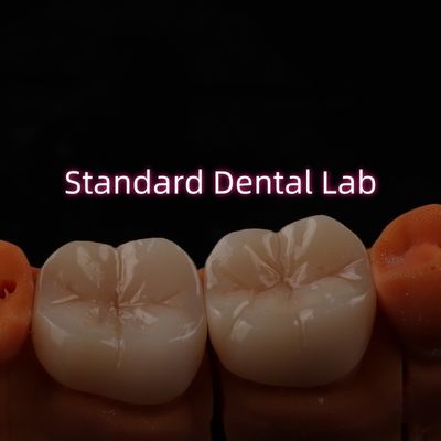 kopen Full Contour Bruxier Monolithisch Zirconia Crown Bridge Tandheelkundig Lab online vervaardiging