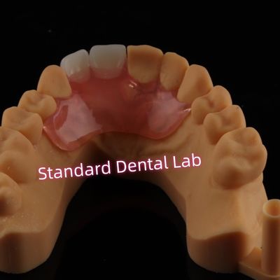 kopen Tandheelkundige valplast Flexible Flipper Protheses Afneembare gedeeltelijke prothese online vervaardiging