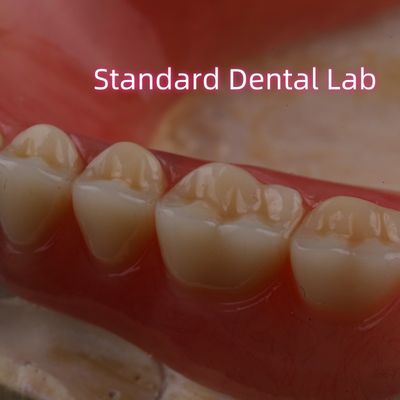 kopen SDL warmtebehandelde acryl partiële tandheelkunde Ivoclar tanden tandheelkundig laboratorium hoge nauwkeurigheid online vervaardiging