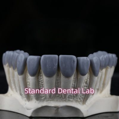 kopen Standaard tandheelkundig laboratorium tandheelkundige kroon Wax Up hoge esthetiek online vervaardiging