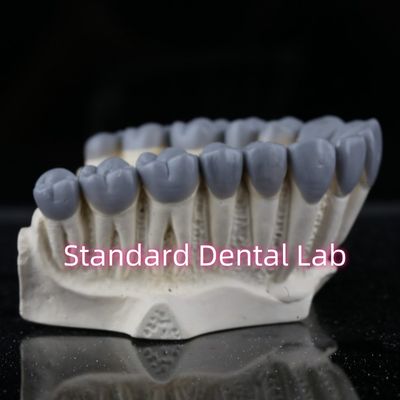 kopen SDL Tandheelkundig Lab Digitaal Diagnostisch Wax Ups Crown Bridge online vervaardiging