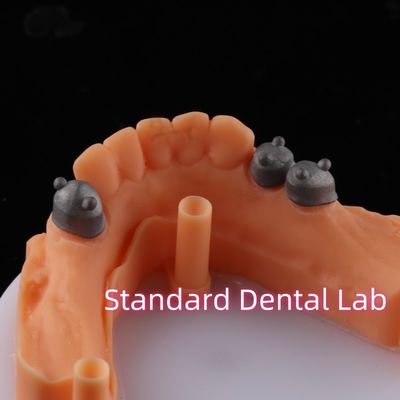 kopen Telescoopkroon Aanhangsel Primaire Secundaire Kroon Niet-prijswaardige NP online vervaardiging