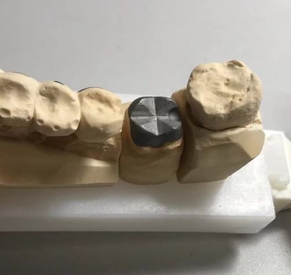 kopen ISO FDA CE tandheelkundige metalen post en kernkroon PFM Good Fit online vervaardiging