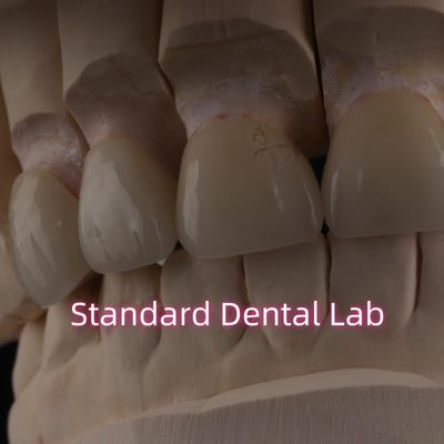 kopen Professionele tandheelkundige laboratorium Zirconia kroon voor vaste restauratie online vervaardiging