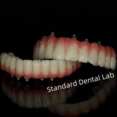 kopen Implantaten met schroefcement en geblokkeerde tandheelkundige restoratie van standaard tandheelkundig laboratorium online vervaardiging