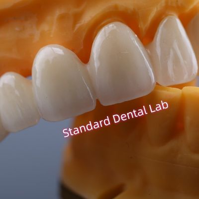kopen CAD CAM Molen Zirconia Crown Bridge Zeer biologisch compatibel online vervaardiging