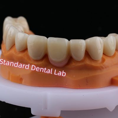 kopen Digitale CAD CAM freeslaag Zirconia brugkroon met roze porselein online vervaardiging
