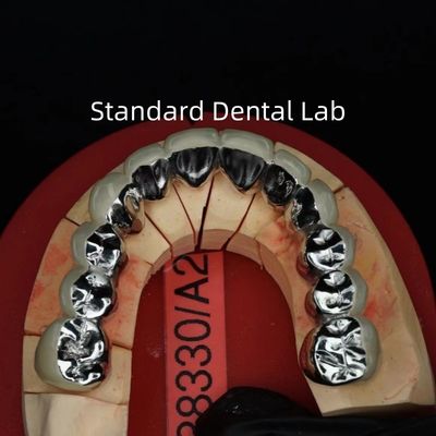 kopen Full Arch Metal Porseleinen Kronen / Brug Precise Esthetische PFM Kronen Tandheelkundige online vervaardiging