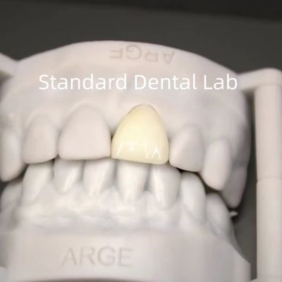 kopen Digitale CAD CAM tandheelkundige lab kronen doorzichtige gelaagde Zirconia kroon online vervaardiging