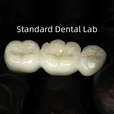kopen Volledige contour hoogtranslucentie solide zirconia online vervaardiging