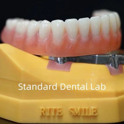 kopen Titanium Implantate Supported Dentures Precise Ivoclar Denture Over Implants ISO FDA CE online vervaardiging