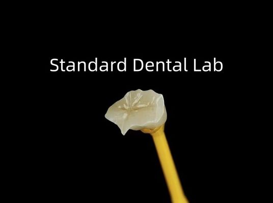 kopen Tandheelkundig porselein Inlay Onlay Zirconia Emax High Esthetics online vervaardiging