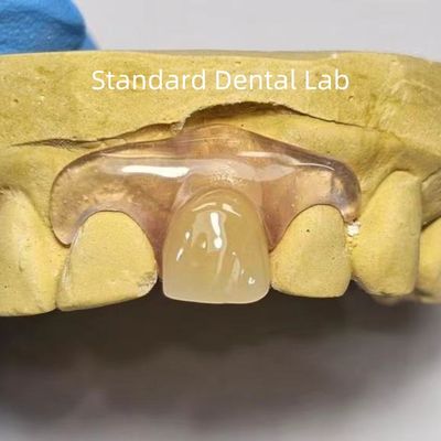 kopen Tandheelkundige TCS Valplast Flexible gedeeltelijke tandheelkundige prothesen Vlekken vervagen Geuren resistent online vervaardiging
