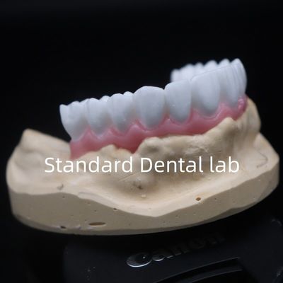 kopen Hoge esthetiek witte tandheelkundige kroon diagnostische was op maat China tandheelkundige laboratorium online vervaardiging