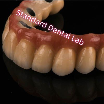 kopen Cobaltchroom Ivoclar Laser gesinterd PFM kroon metaal porselein brug A1 A2 A3 online vervaardiging