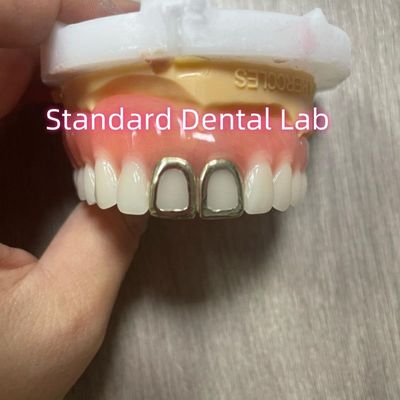 kopen ISO volledige acrylprothesen met gele gouden tanden open gezicht online vervaardiging