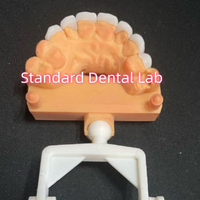 kopen Natuurlijk uitziende gelamineerde zirconia Emax veneers Dikte 0,6 mm online vervaardiging