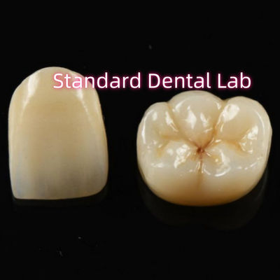 kopen Biocompatibel materiaal Esthetische Zirconia kroon Zirconia brug tanden online vervaardiging