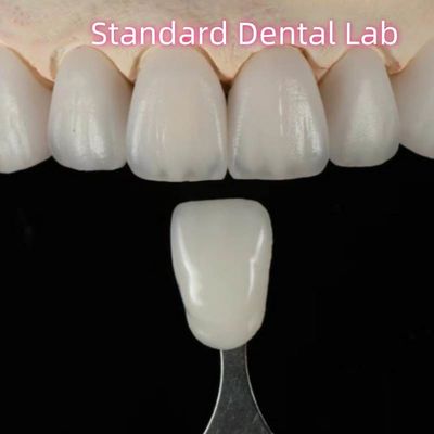 kopen Hoge esthetische natuurlijke aangepaste Aidite Zirconia tandheelkundige brug online vervaardiging