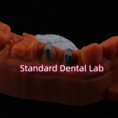 kopen Metal Post Core Crown CAD CAM Porselein / Zirconia Coping Volledige Zircnonia Bruxier Kronen online vervaardiging