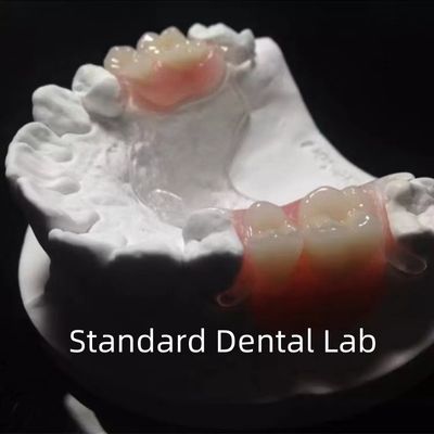 kopen Flexibel helder gegoten metaal frame gedeeltelijke gebit hoge esthetiek perfecte pasvorm online vervaardiging