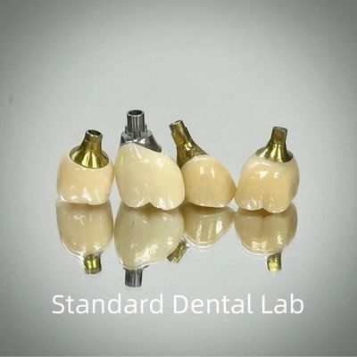 kopen Professionele Zirconia schroef vastgehouden implantaat kroon Titanium CAD CAM online vervaardiging