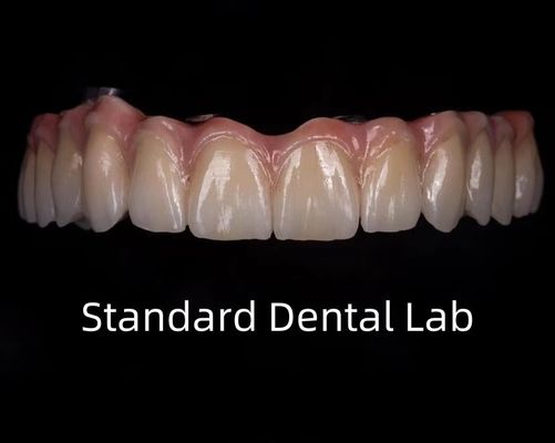 kopen Titanium Full Zirconia Bridge Translucentie op de implantaatbalk online vervaardiging