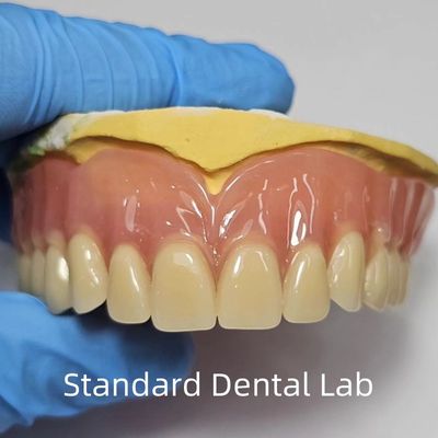 kopen Standaard Ivoclar Complete Acrylic Prothesis Professional FDA gecertificeerd online vervaardiging