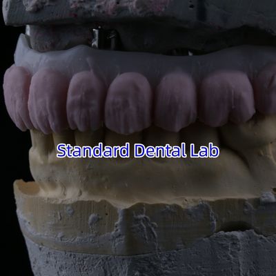 kopen Porselein All On Four Zirconia brug hoge esthetiek tandheelkundige implantaat brug online vervaardiging