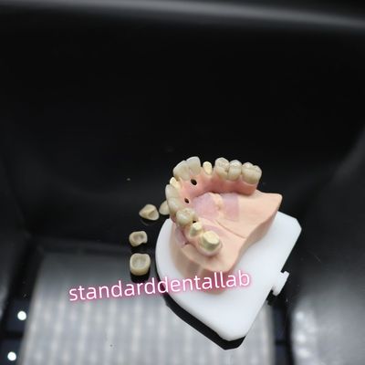 kopen Digitale tandheelkundige Malo-implantatiebrug Titanium Ivoclar Hybride Zirconiabrug online vervaardiging