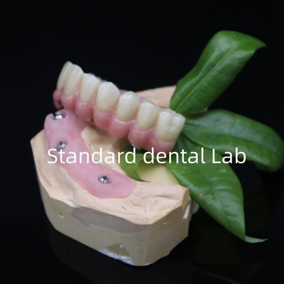 kopen Gekruimd op 6 volle Zirconia brug tandheelkundige hoge nauwkeurigheid over Ti basis online vervaardiging