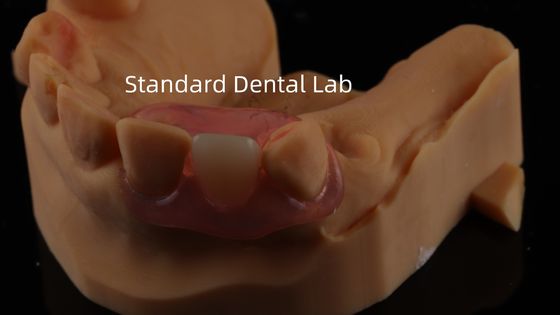 kopen Tandheelkundige TCS Valplast Flexible Partial Protheses Nesbit Valplast Finish China Dental Lab Valplast Clamp online vervaardiging