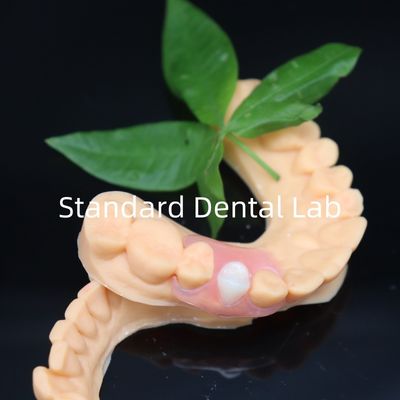 kopen Esthetic Valplast Flexible Protheses met gratis herverzorging in 3 dagen China Dental Lab online vervaardiging