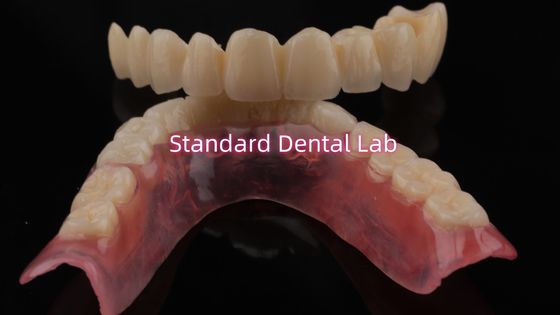 kopen Zeer duurzaam en natuurlijk uitziend gelaagd porselein voor gelaagd tandheelkundig circonia kroon China tandheelkundig laboratorium online vervaardiging