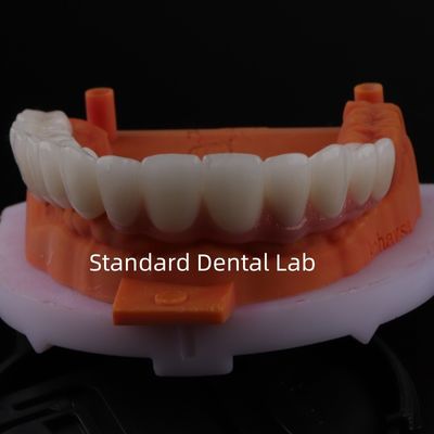kopen Goed passend Precieze Esthetische Zirconia Porselein Kroon Roze Porselein Met Bleek Schaduw online vervaardiging