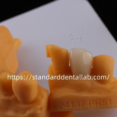kopen Volledige contour tandheelkundige lab kronen hoge doorzichtigheid solide zirconia kroon China tandheelkundige lab online vervaardiging