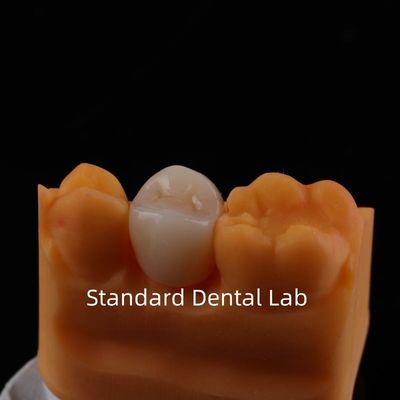 kopen Volledige contour Zirconia kroon Uitzonderlijke sterkte en esthetiek Geen porseleinen overlay Achterkroon China tandheelkundig laboratorium online vervaardiging
